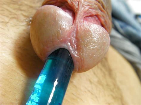 Urethra 9 Pics Xhamster