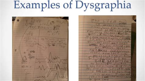dyslexia dysgraphia dyscalculia workshopvideo youtube