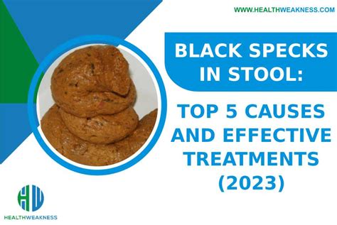 black specks  stool top    effective treatments