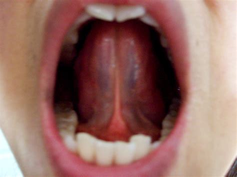 tongue check  health