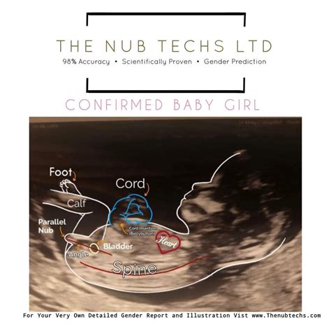 Pin By Apurva Patil On Pregnant Stuff Gender Prediction Nub Theory