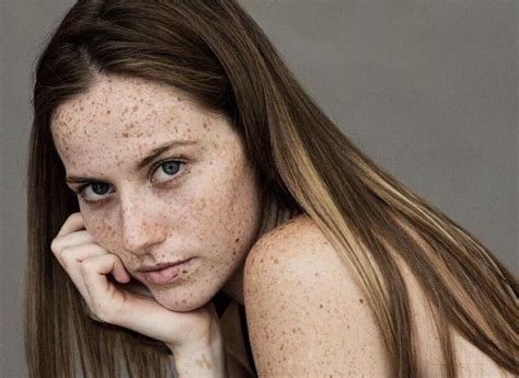 Pin On Freckled Girls