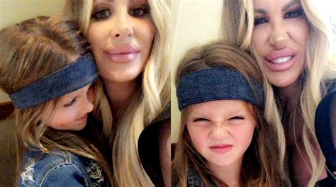 photos kim zolciak slammed by fans for od ing on her lip injections