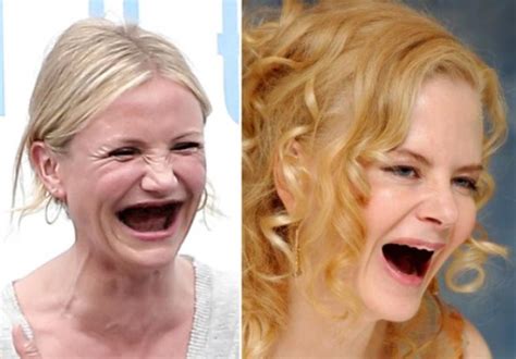 celebrities  teeth funcage