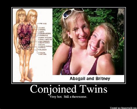 Conjoined Twin Porn 141119 Hot Conjoined Twins Porn