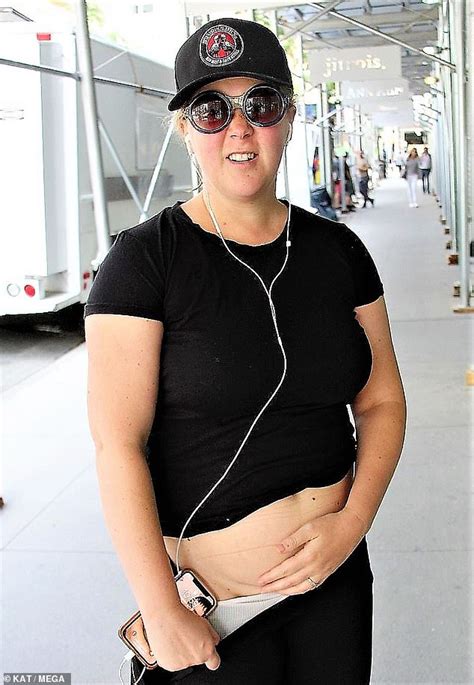 Amy Schumer Proudly Displays Her C Section Scar On New York City Street