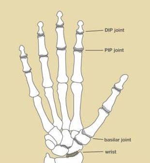 osteoarthritis   hand uconn musculoskeletal institute