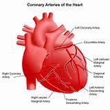Images of Coronary Arteries Picture