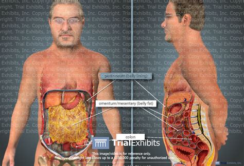 Normal Male Anatomy Of The Abdomen Trialexhibits Inc