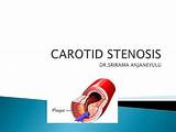 Pictures of Stenosis Of Carotid Artery