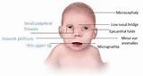 Infant Toddler Symptom Checklist