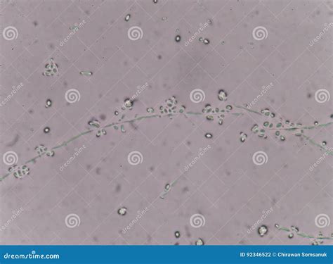 yeast cells  urine specimens stock photo image  life baking