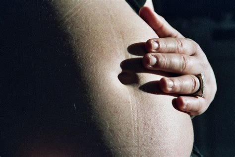 Fueling Modern Pregnancy Myths