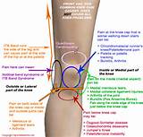 Photos of Knee Injury Diagnose
