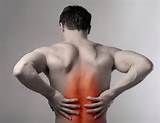 Pictures of Acute Mid Back Pain