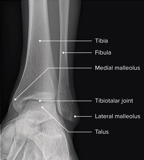 ankle joint anatomy concise medical knowledge