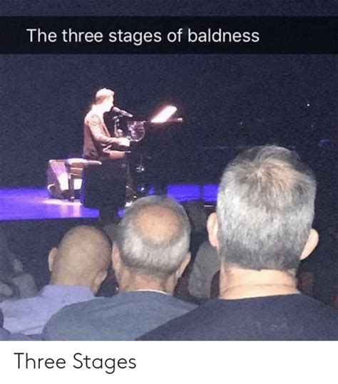 🔥 25 Best Memes About Baldness Baldness Memes