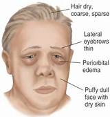 Medical Facial Diagnosis