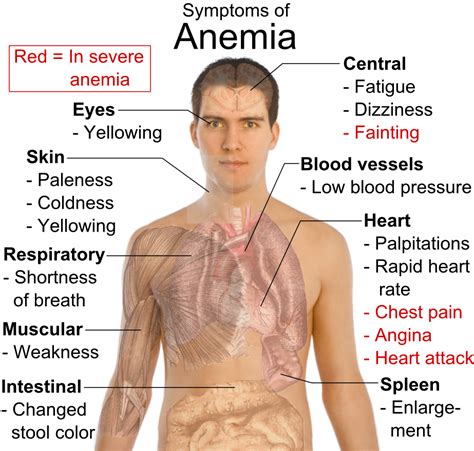 iron deficiency anemia symptoms chemical elements
