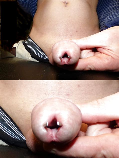 Bdsm Extreme Insertions Urethral Anal Femdom 98 Pics