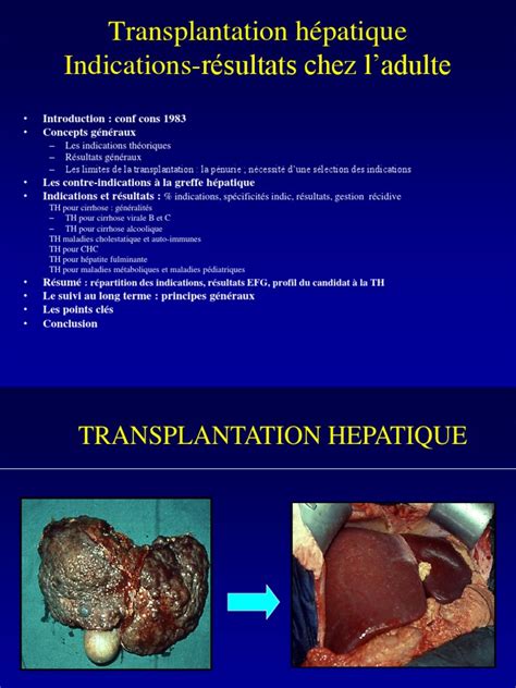 Transplantation Hepatique Pdf Cirrhose Greffe Dorgane