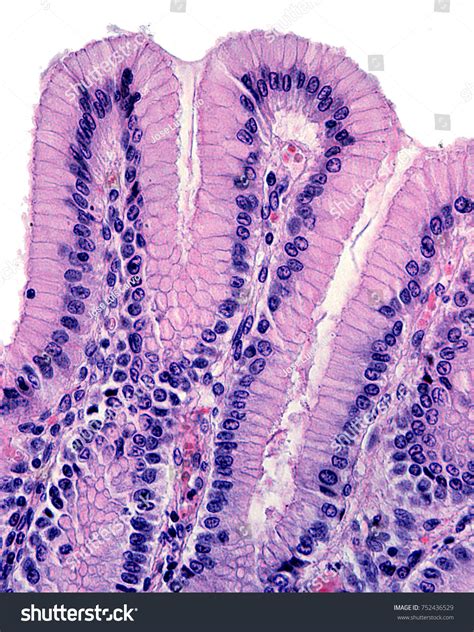 simple columnar epithelium images stock   objects