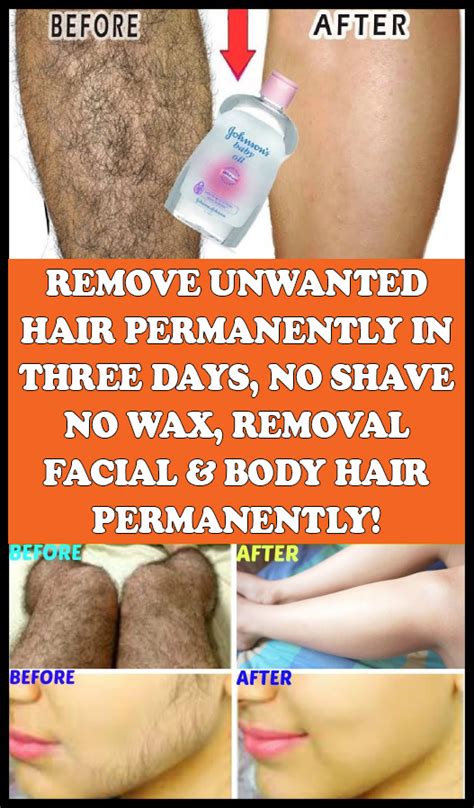 remove unwanted hair permanently in three days no shave no wax removal