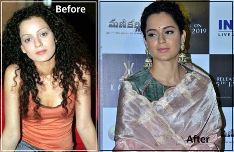 Bollywood Celebrities Before And After Plastic Surgery