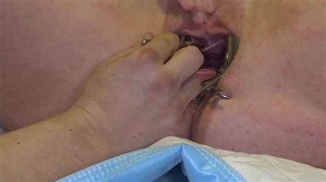 Analslut Filled With Her Own Piss In Speculum Gaping Pussy