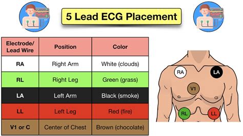 place   lead ecg acronym mnemonic diagram  electrode