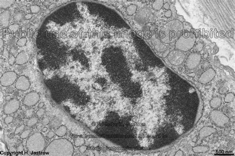 euchromatin dr jastrow s electron microscopic atlas
