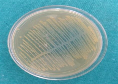 Growth Of E Coli On Cled Agar Download Scientific Diagram