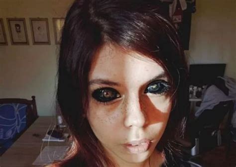 Woman Goes Blind After Dyeing Her Eyeballs Black In 2020 Tattoo Skin