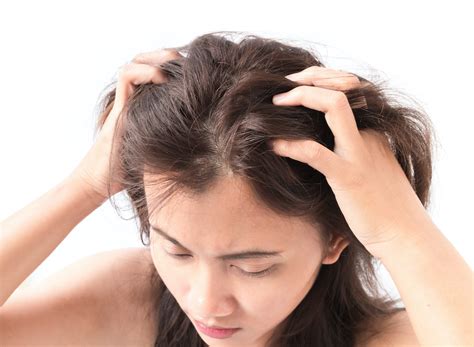 reasons   scalp  itchy       buckhead dermatology