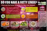 Fatty Liver Diagnosis