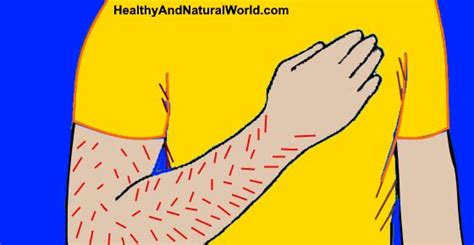 right arm numbness or tingling causes and home treatments