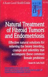 Fibroid Tumors Pictures Photos