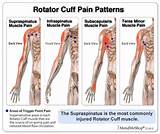 Back Exercises Rotator Cuff Injury