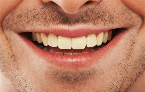 9 Things You Can Do To Get A Perfect Smile Men’s Health