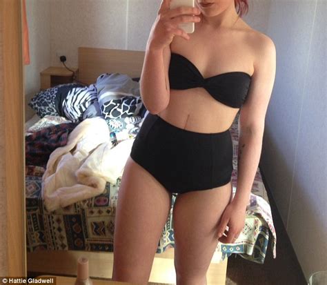 blogger haddie gladwell with bowel disease speaks about life with an ostomy bag daily mail online