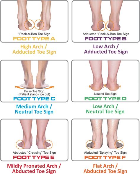 understanding foot types  managing  adolescent athlete nolaro