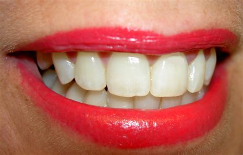 mouth lips smile   photo  freeimages
