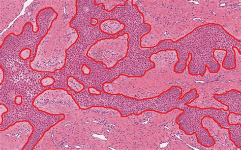 pathology resources  tissue image analysis