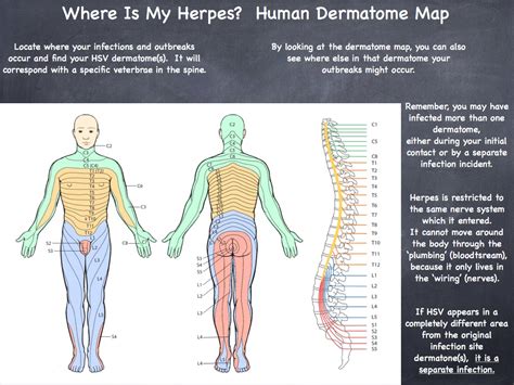 herpes zoster dermatome map dermatome map