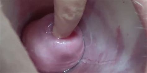 Its Porn Extreme Cervix Playing With Insertion Metal