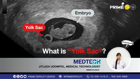 yolk sac prime fertility clinic