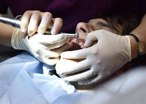 cost  childrens tooth extraction rises   million  year