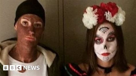 why do australians keep wearing blackface bbc news