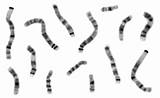 Karyotype Chromosomes Devil Tasmanian Construct Staple Attached Questions sketch template