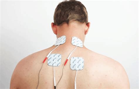 Tens Unit Placement For Fast Relief Of Neck Pain